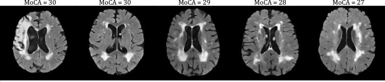 Fig. 20