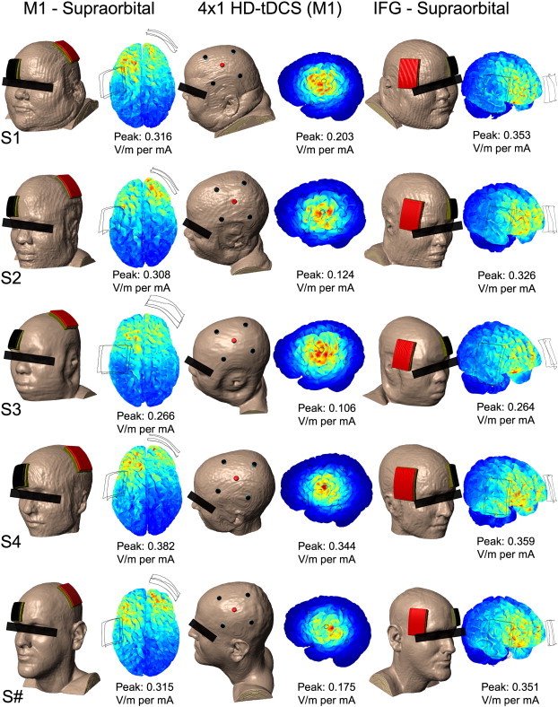 Fig. 2