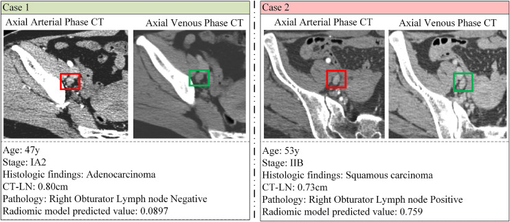 Fig 4