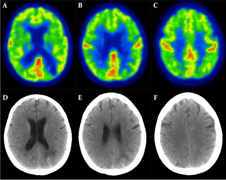 Fig. 4