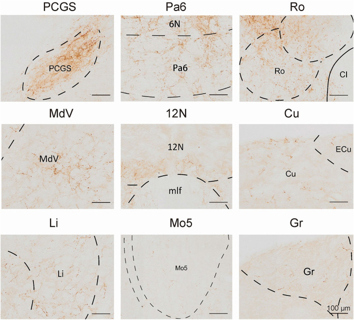 Figure 12