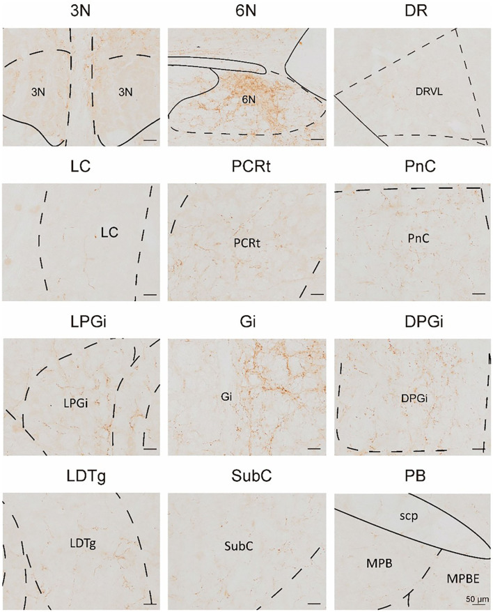 Figure 14