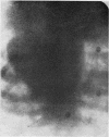 235