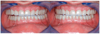 Figure 25