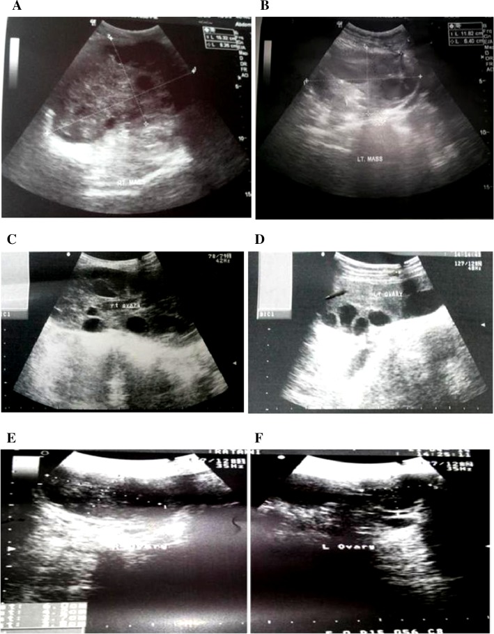 Fig. 1