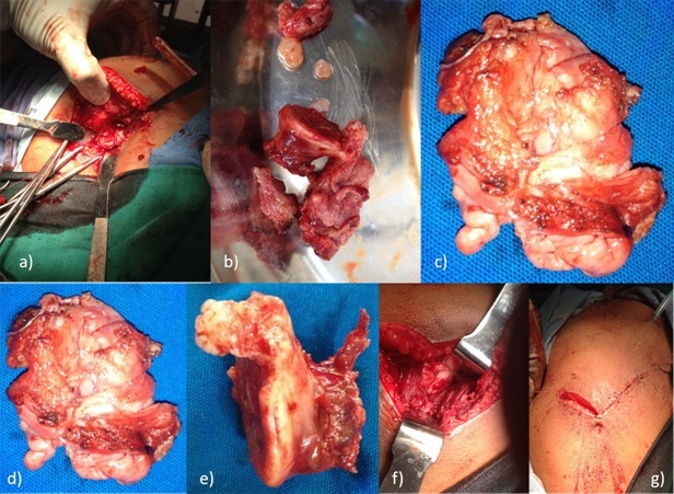 [Table/Fig-3]: