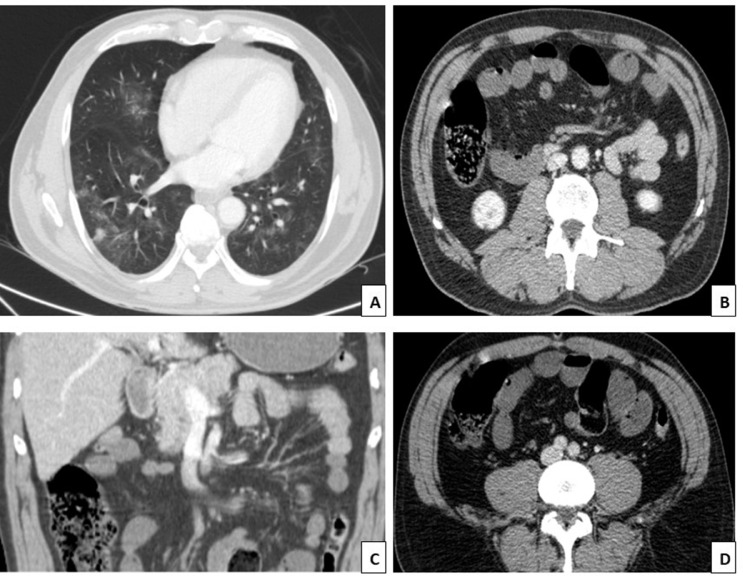 Fig. 1 – (