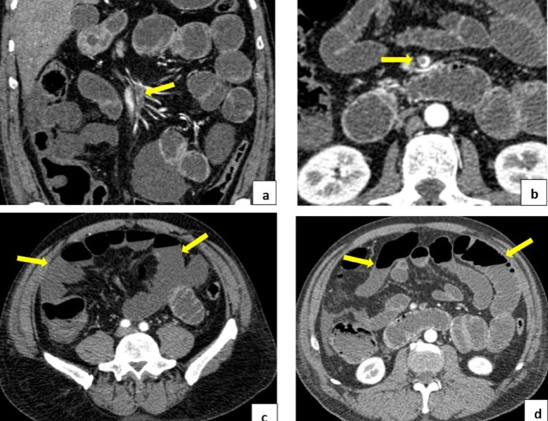 Fig. 2 – (