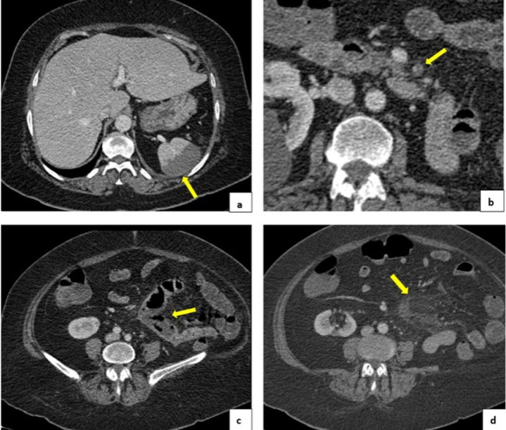 Fig. 4 – (