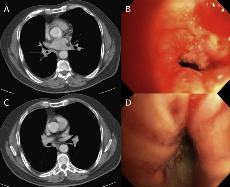 Fig. 1