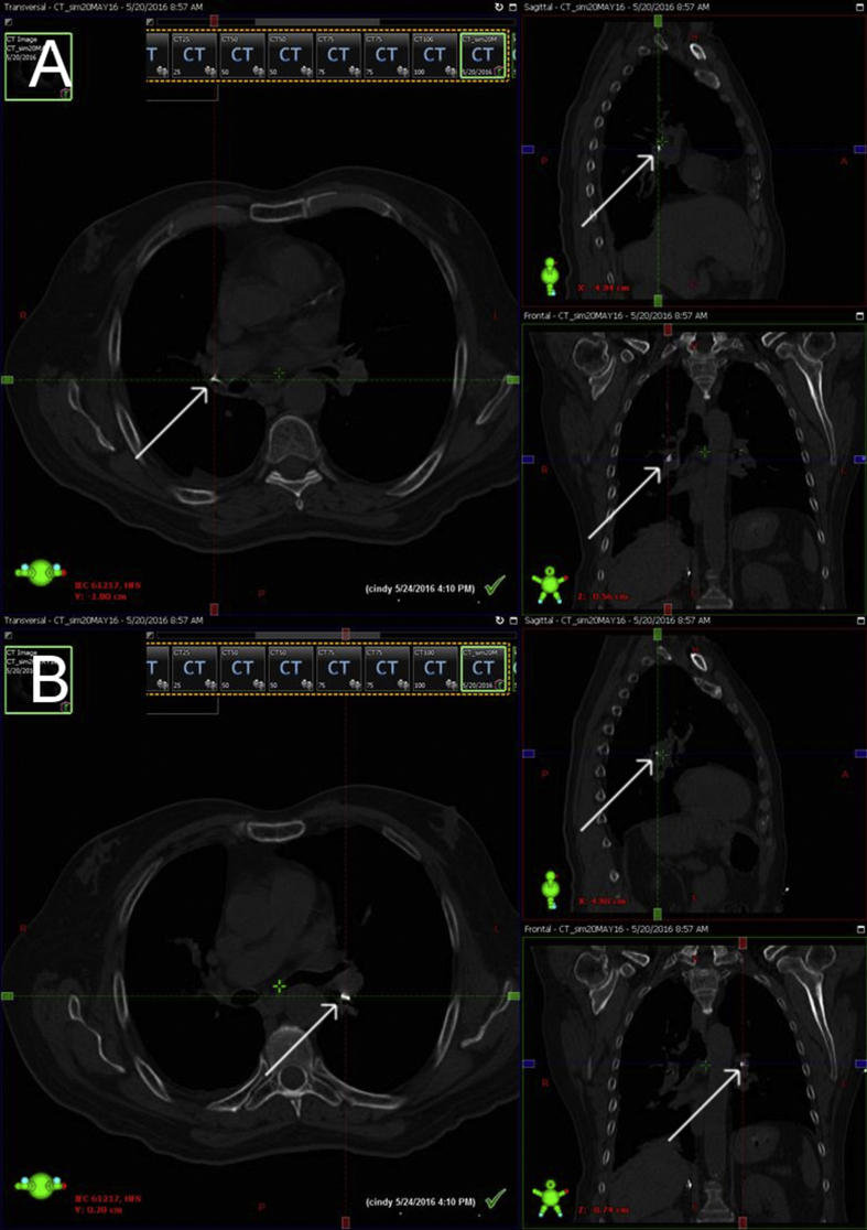 Fig. 3