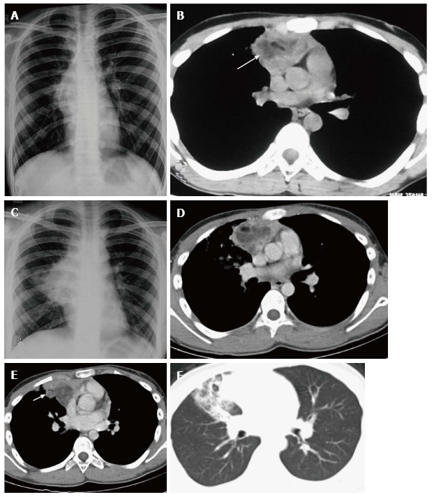 Figure 15