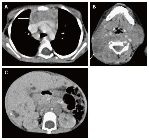 Figure 22