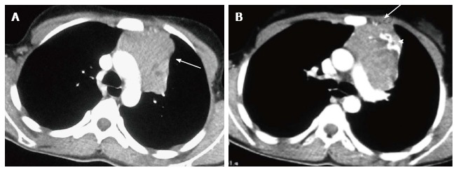 Figure 17