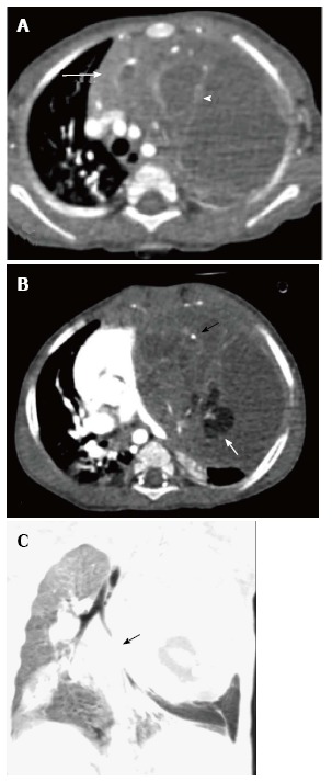 Figure 21