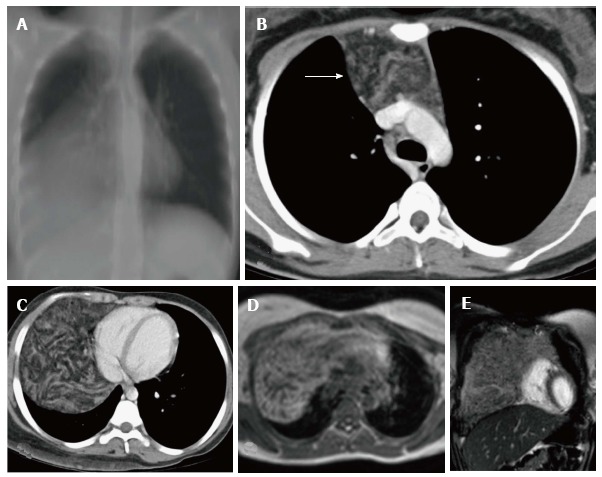 Figure 18