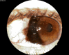 Fig. 12