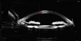 Fig. 11