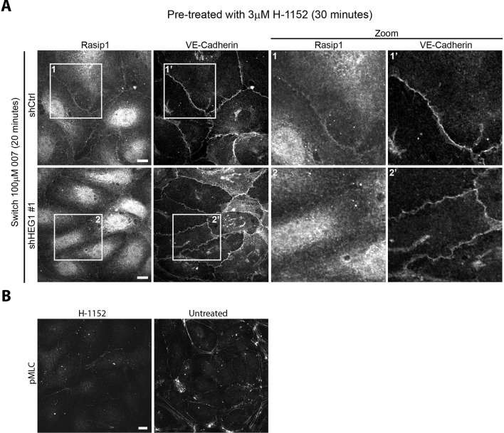 Figure 3—figure supplement 2.