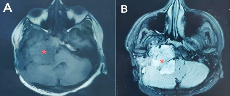 Fig.1