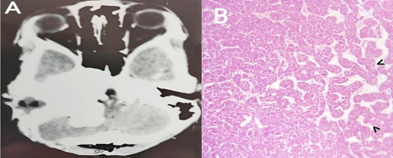 Fig.2