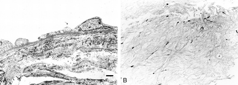 Fig 3.