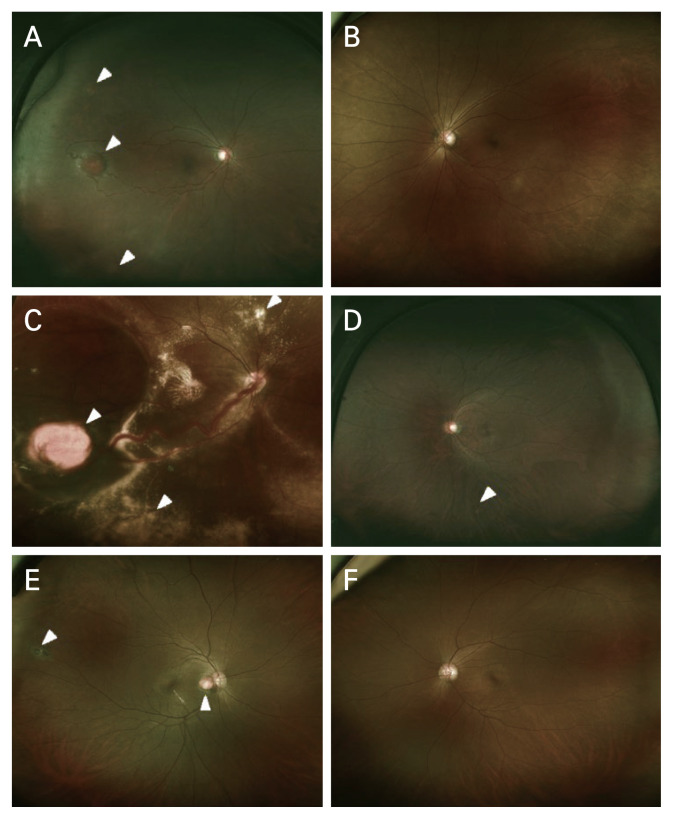 Fig. 2