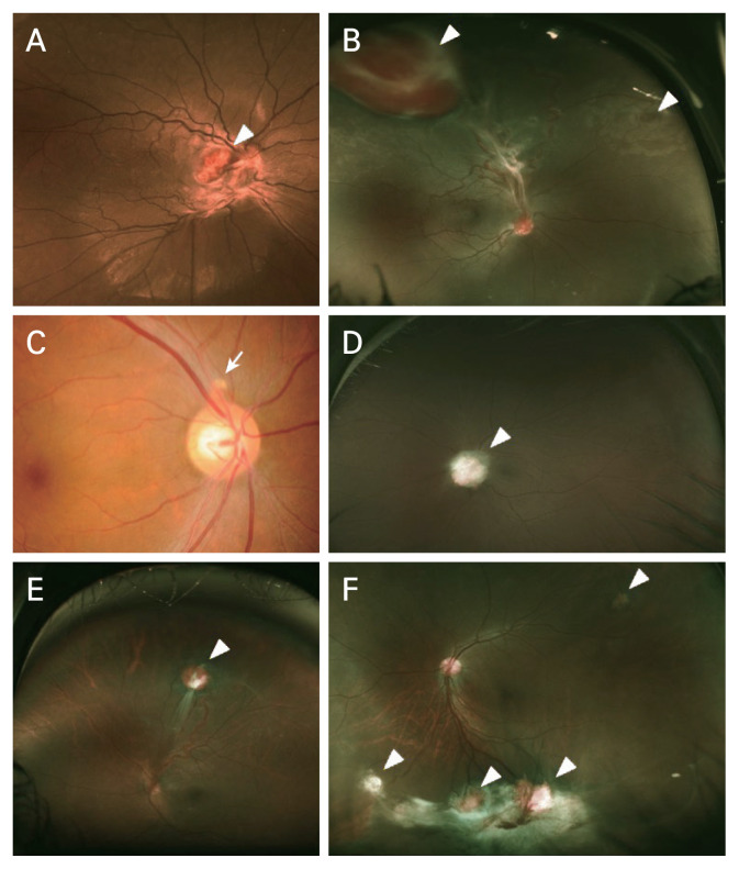 Fig. 1