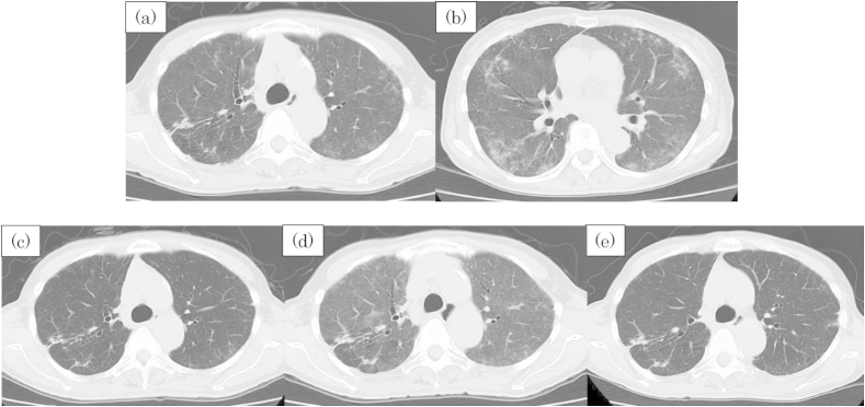 Fig. 2