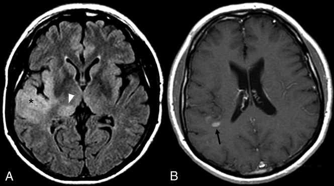 Fig 3.