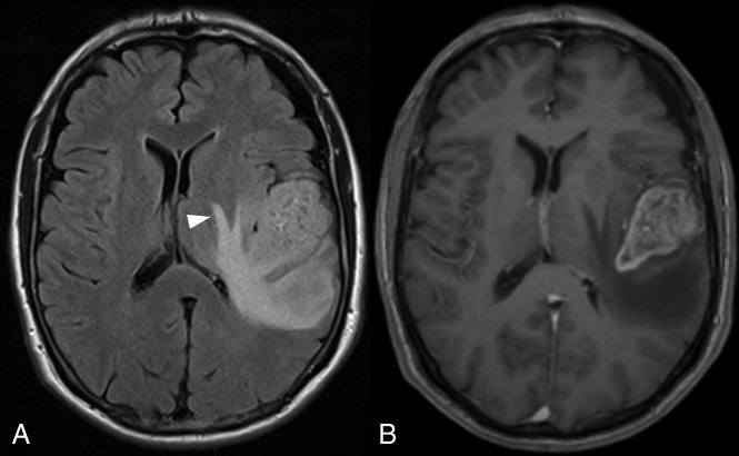 Fig 2.