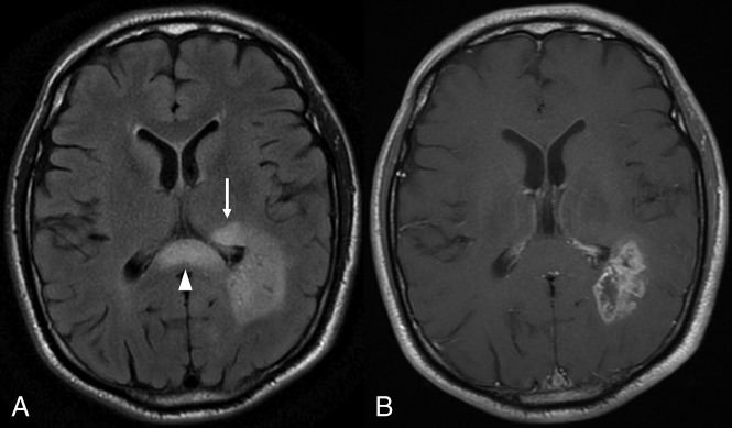 Fig 4.