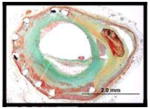 graphic file with name nihms283817t3.jpg