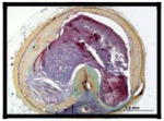graphic file with name nihms283817t8.jpg