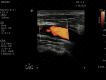 Fig. 17