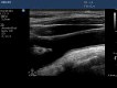 Fig. 11