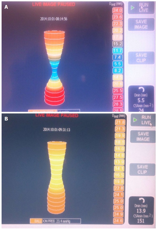 Figure 12