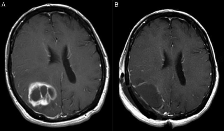 Fig. 2.