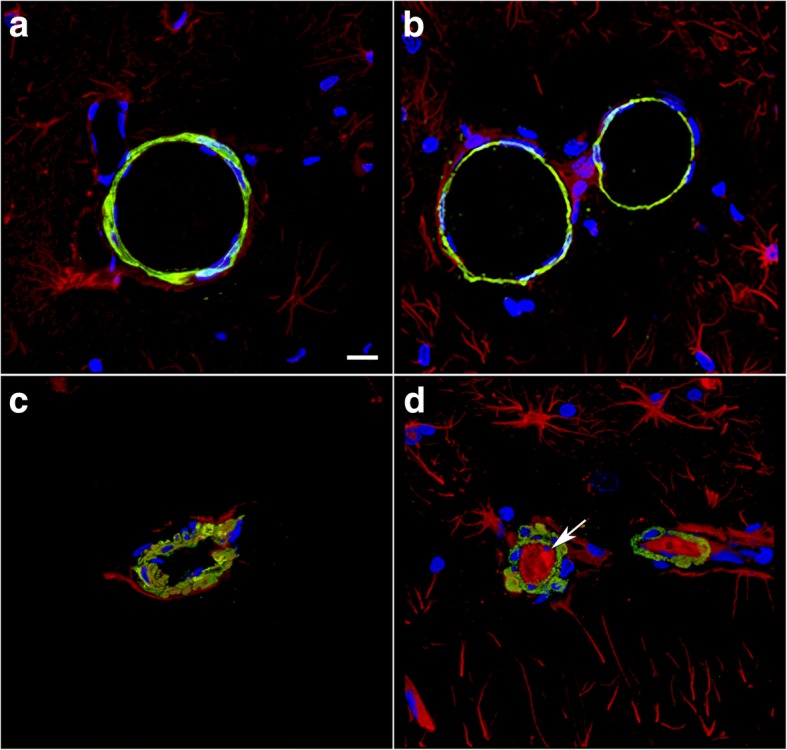 Fig. 12