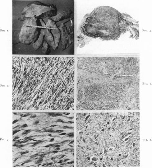 FIG. 1, 2, 3, 4, 5, 6.