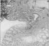 87