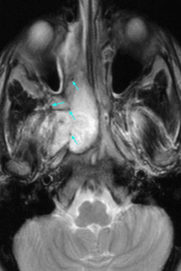 Fig. 1