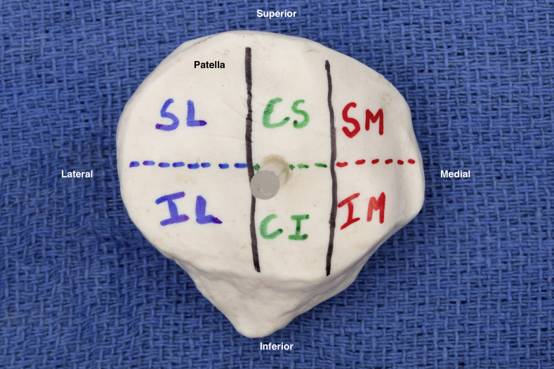 Fig 1