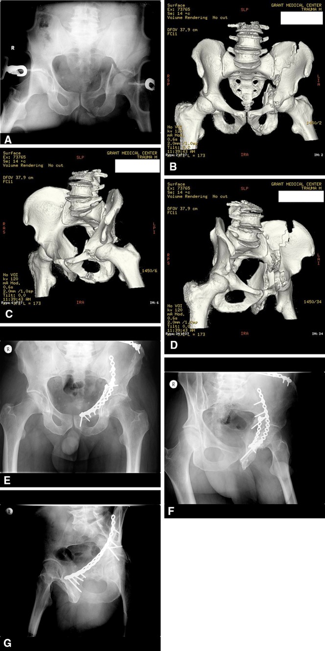 Fig. 1A–G