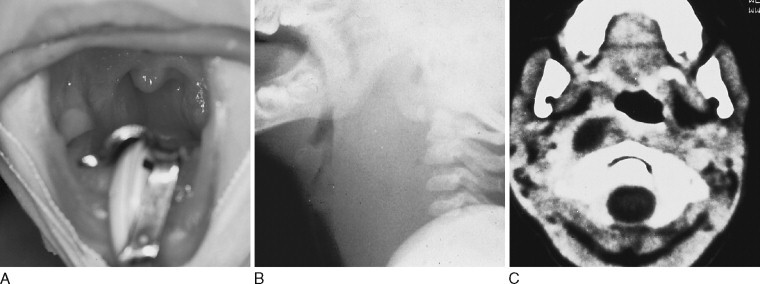 Figure 11-5