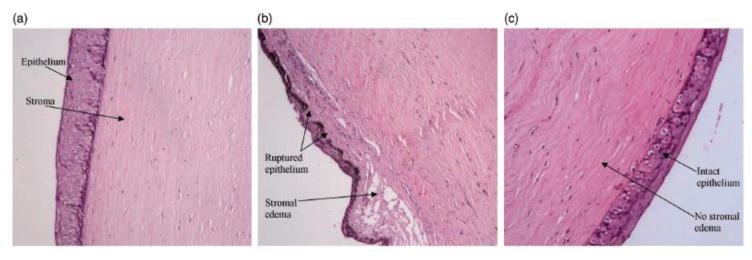 Fig. 14