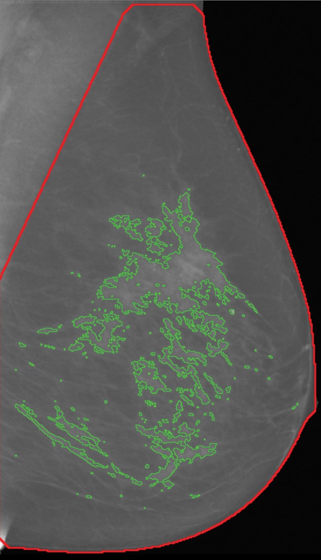 Figure 1a: