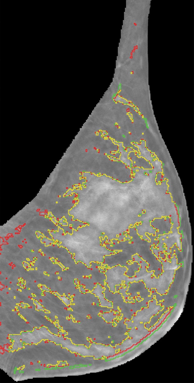 Figure 2c: