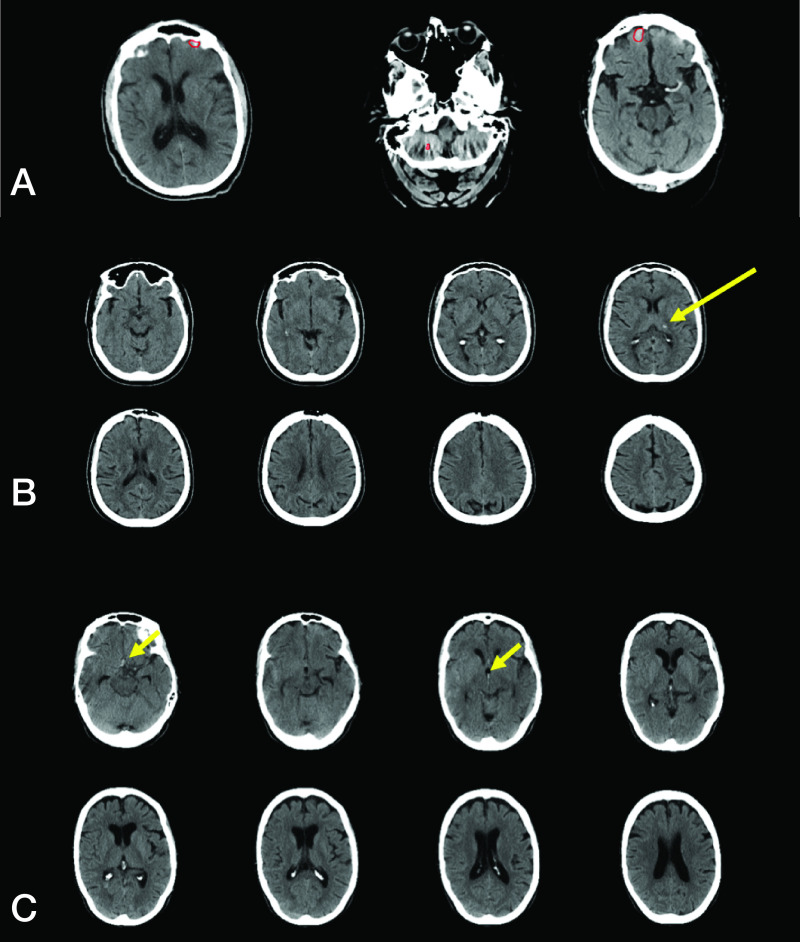 FIG 2.