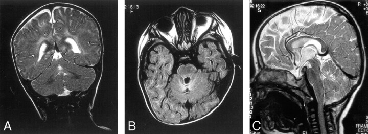 Fig 2.